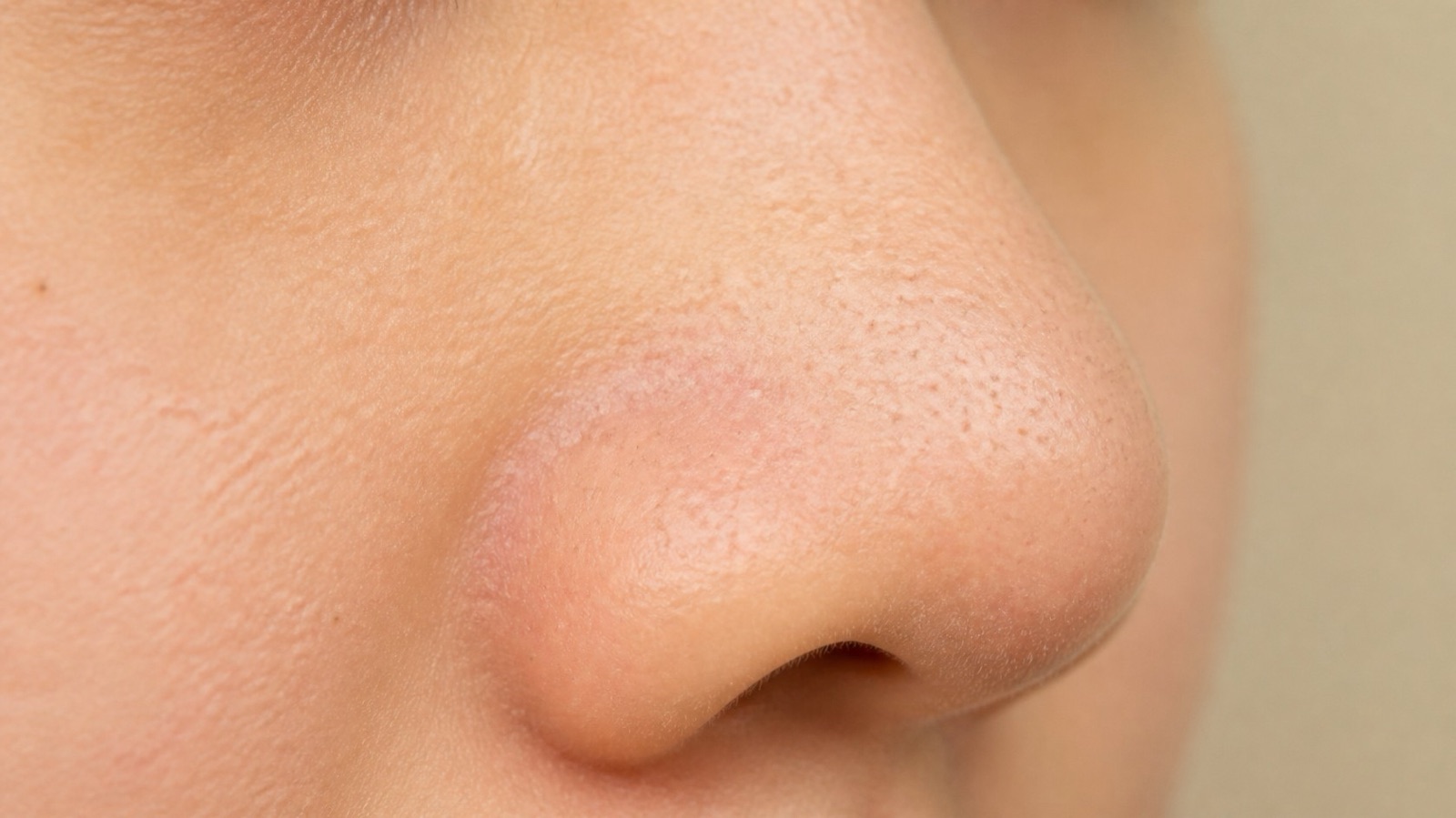 Sebaceous Filaments vs Blackheads: Why the Dots on Your Nose Keep Coming Back