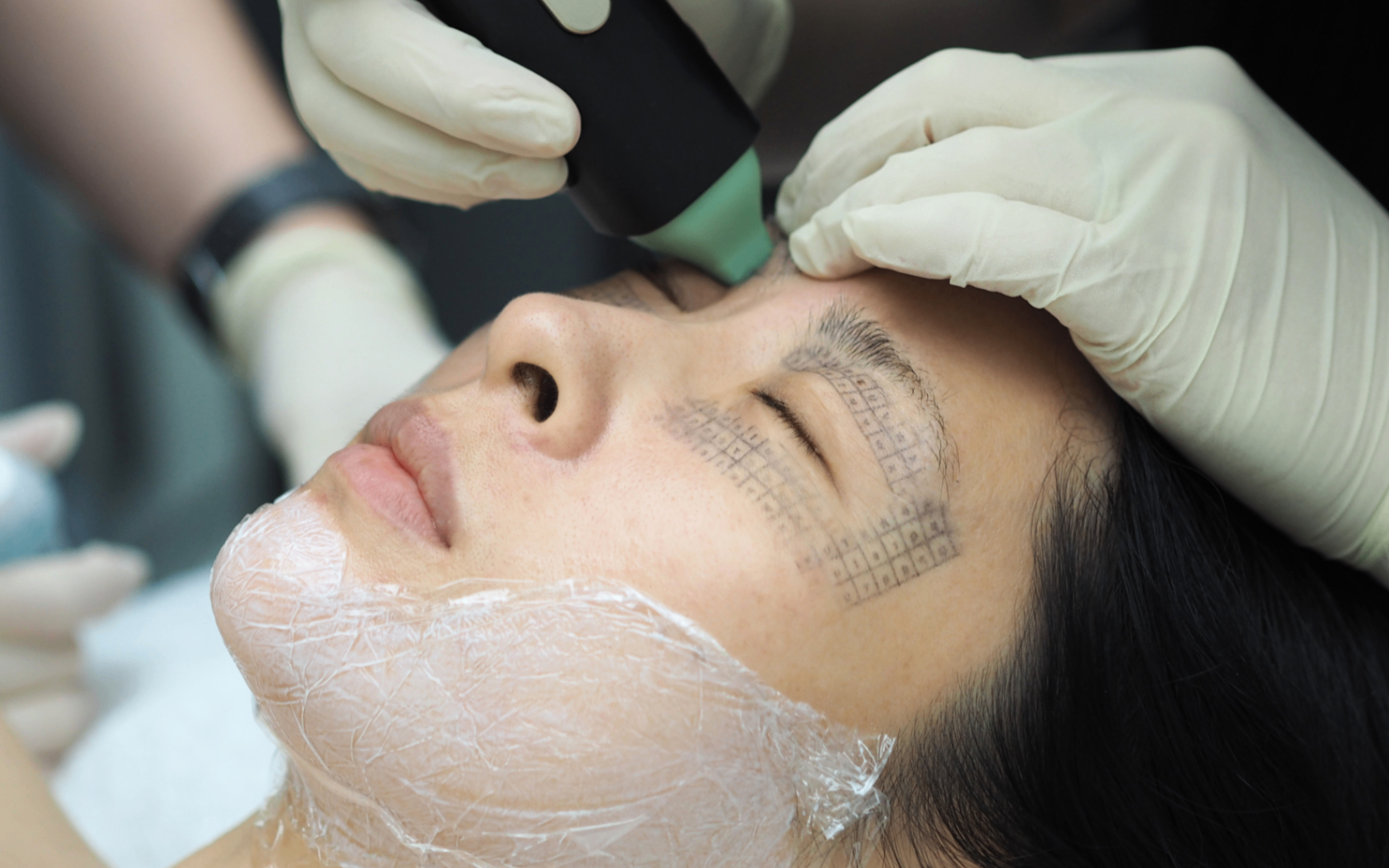 Density Upper & Lower Eye