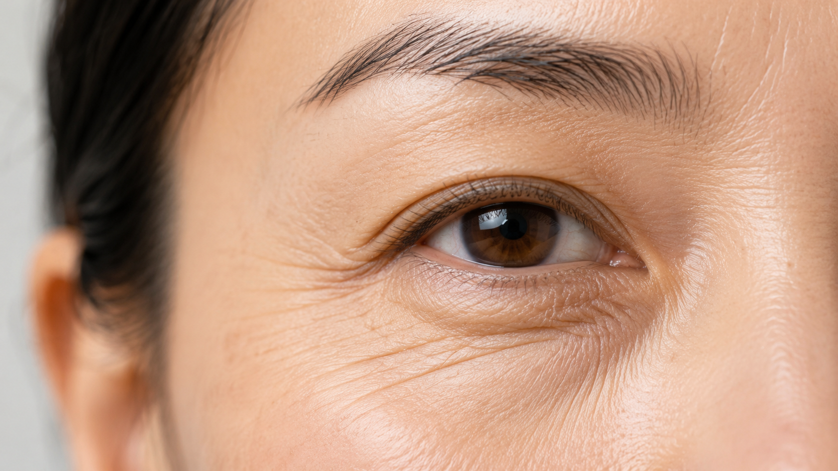 Eye wrinkles & fine lines