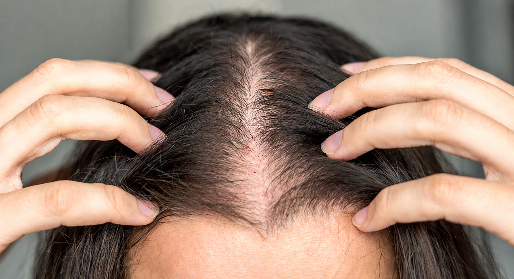 Dormant or weakened follicles