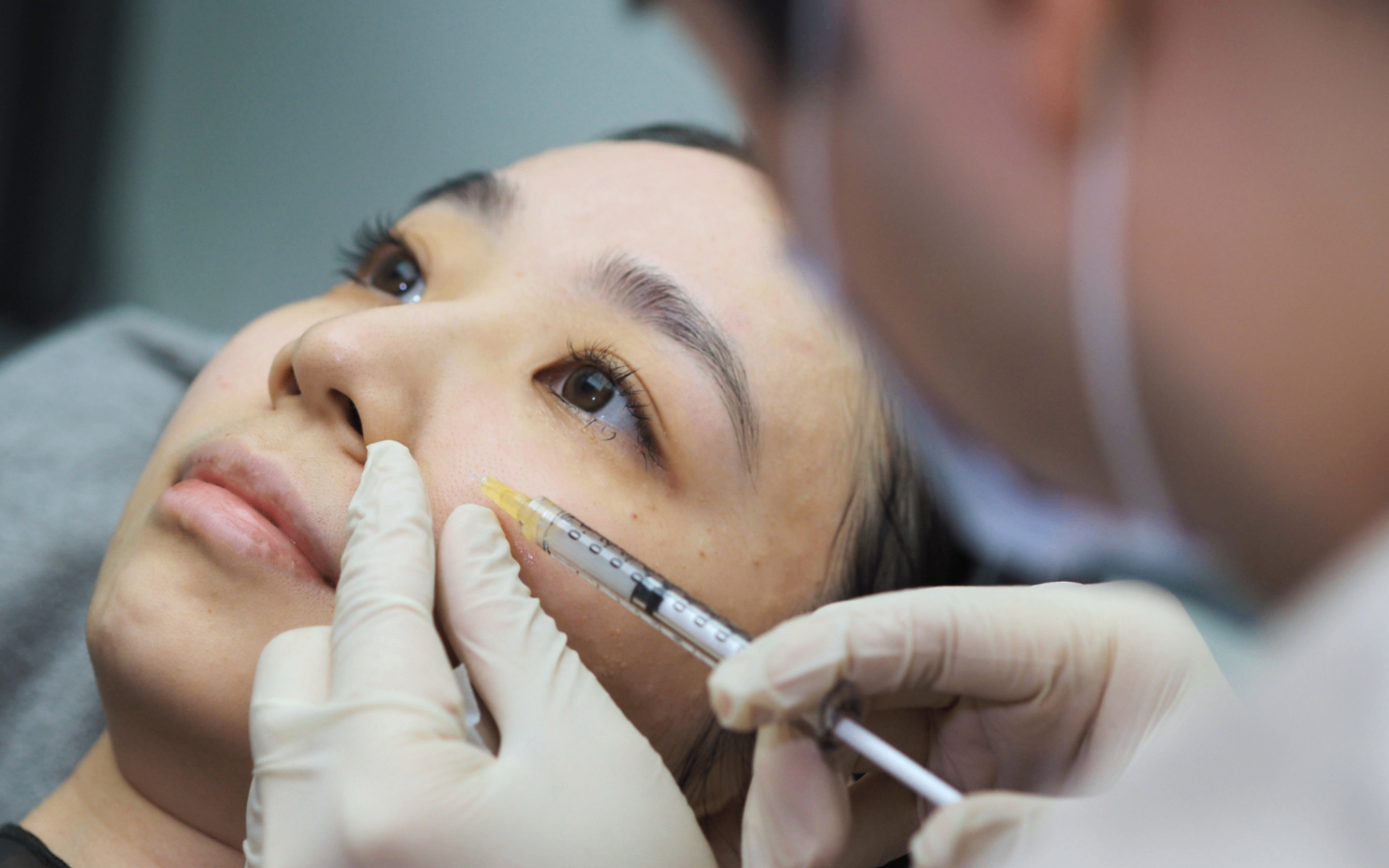 Hyaluronic Acid Filler
