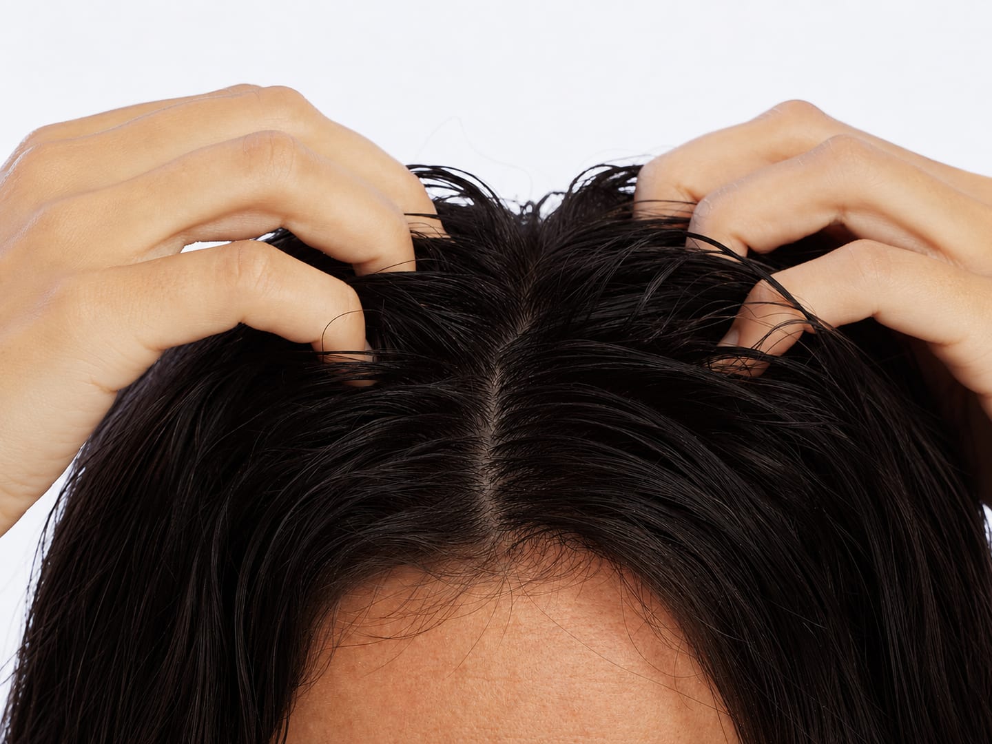 Scalp Treatment for Hair Loss: What Actually Works in Singapore