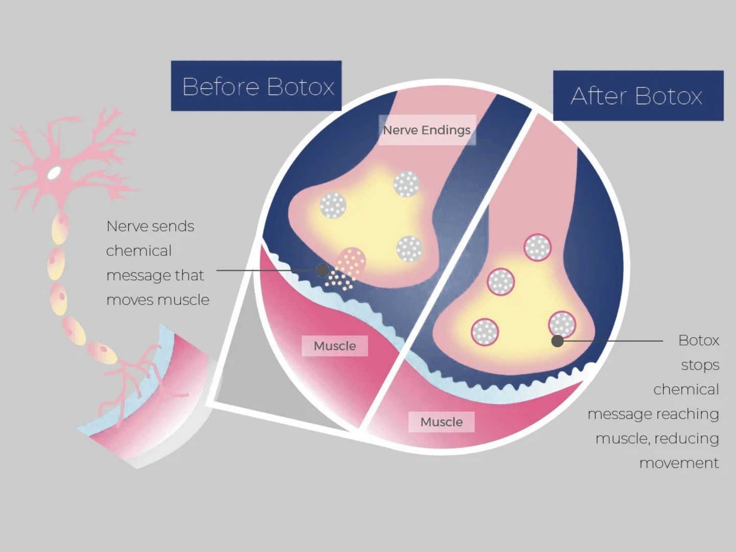 Treatment process