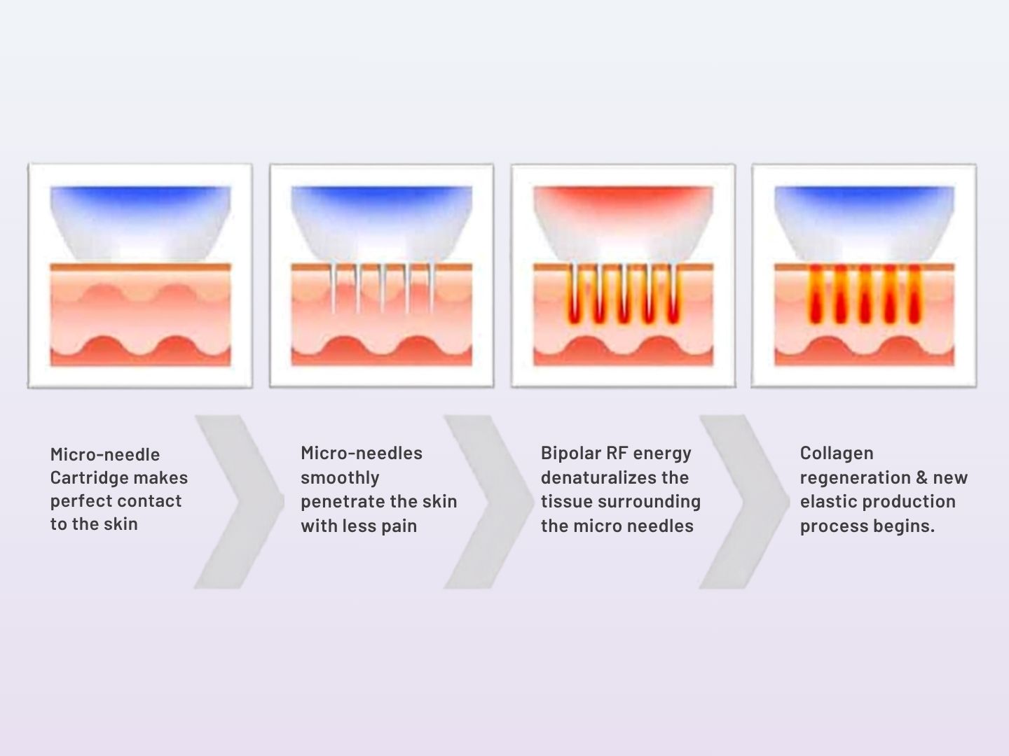 Treatment process