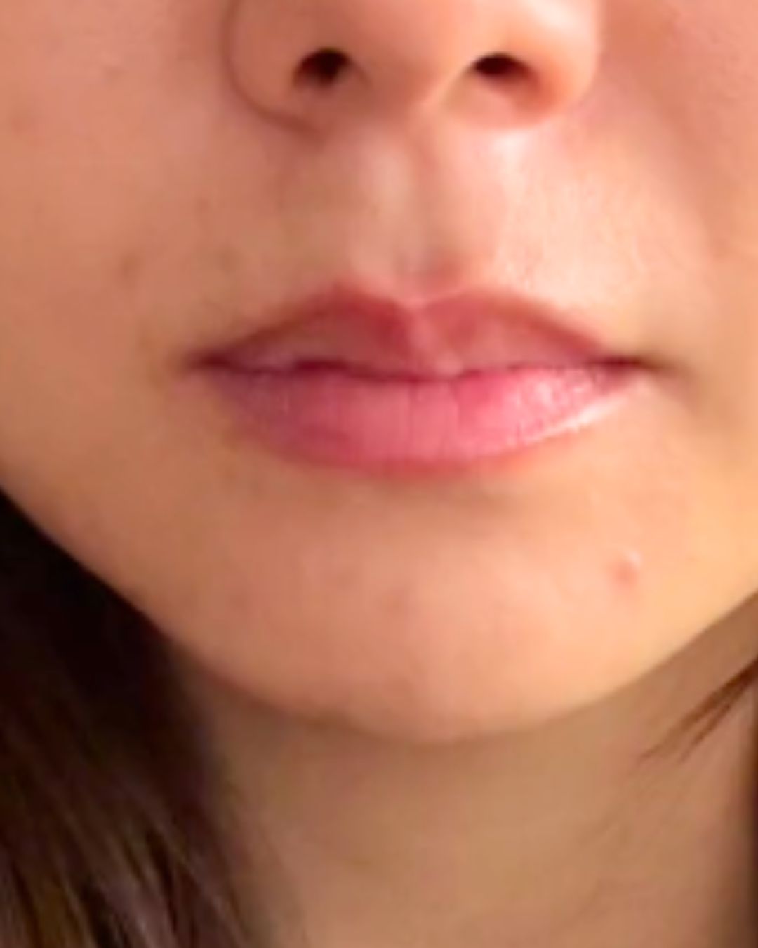 After treatment