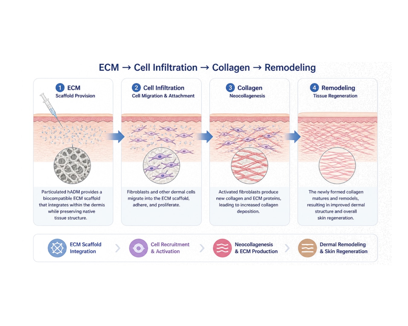 Four-stage diagram showing ECM scaffold provision, cell infiltration, collagen production and dermal remodelling