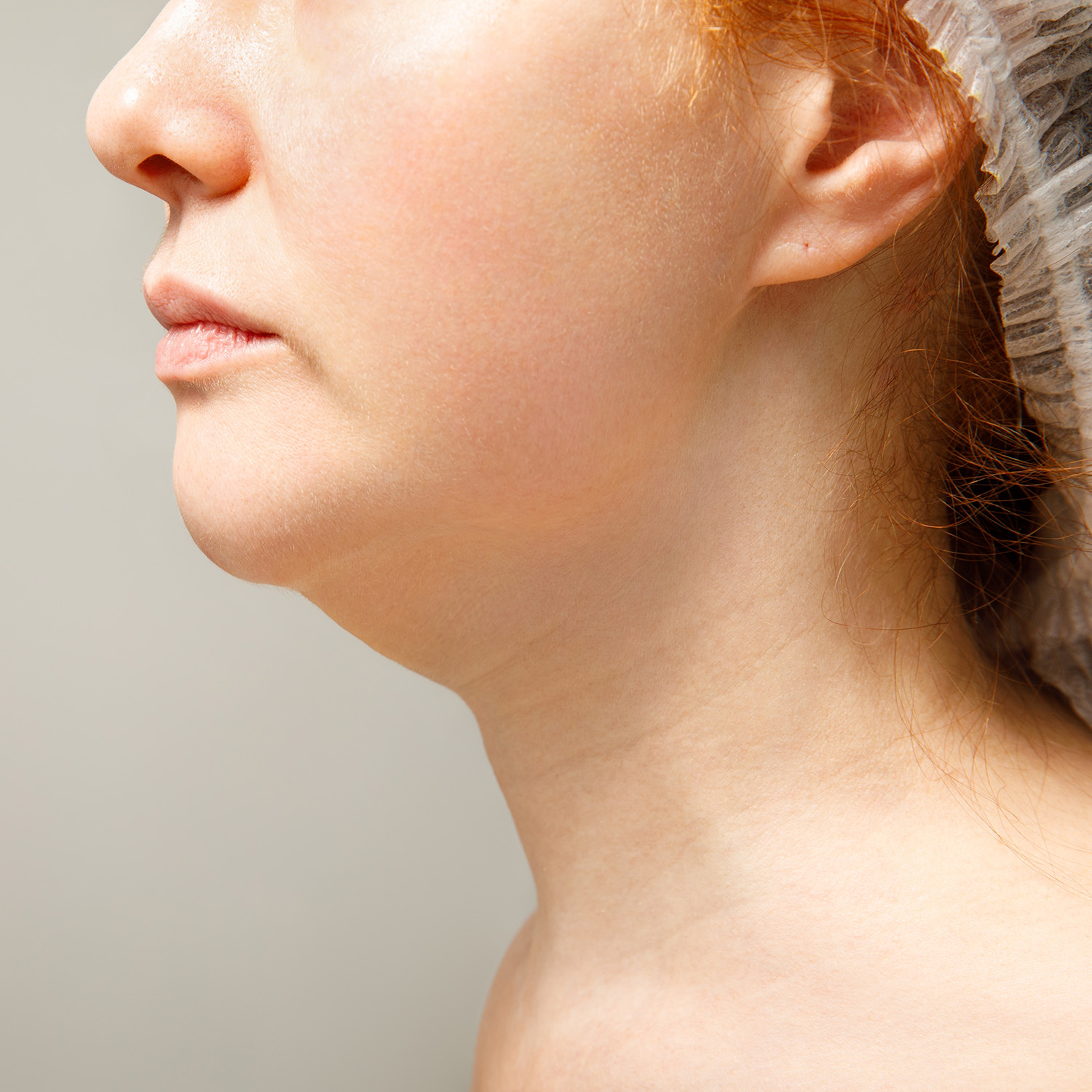 Short Chin / Jawline Profile