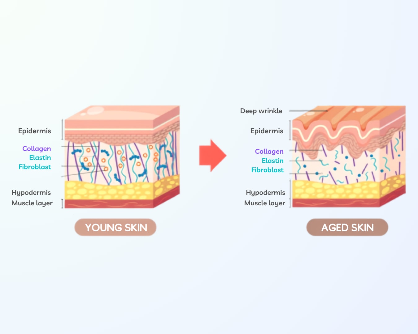 Cross-section comparison of young skin and aged skin showing reduced collagen, elastin and fibroblasts with deeper wrinkles