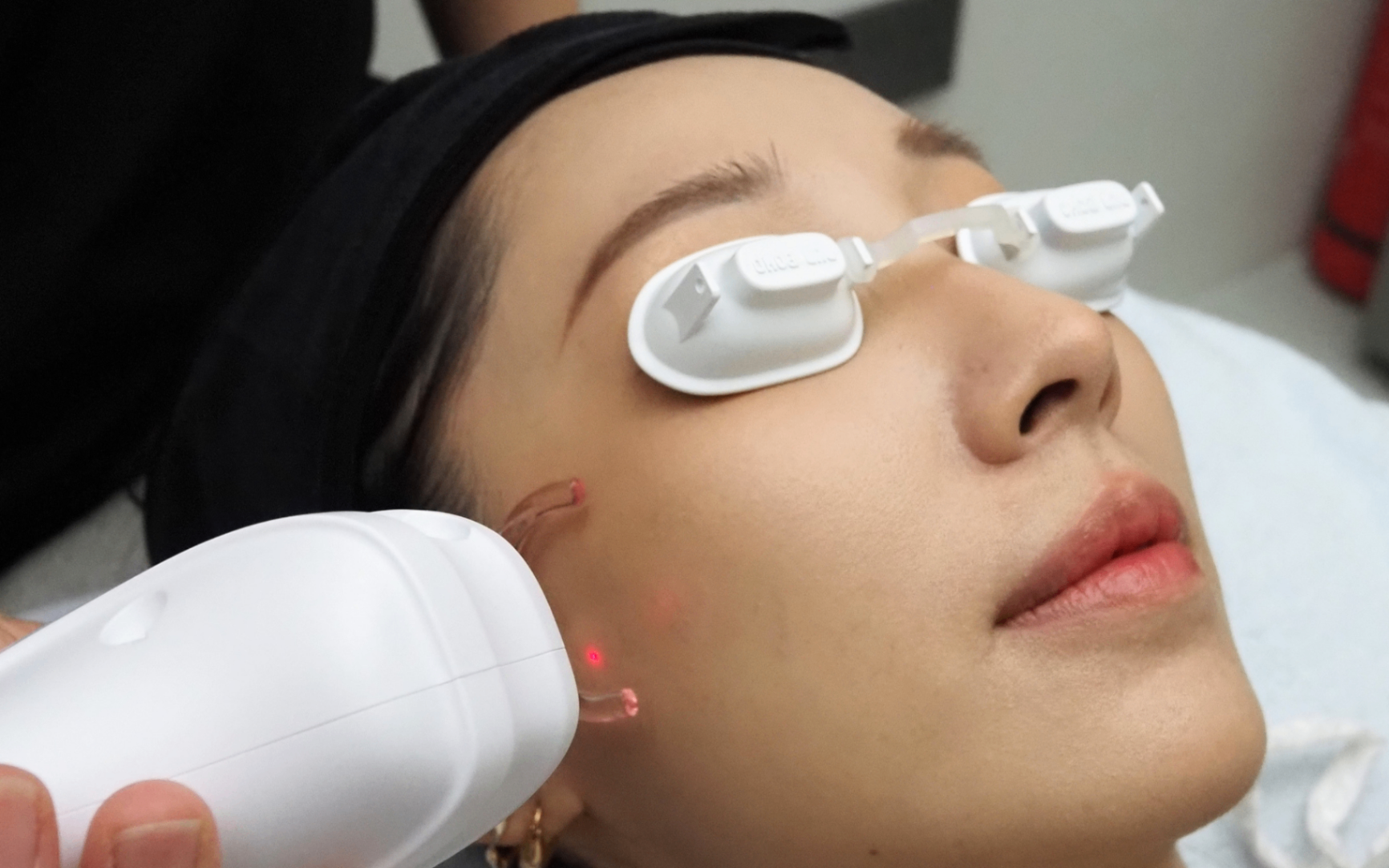 Laser Skin Tag, Wart & Mole Removal