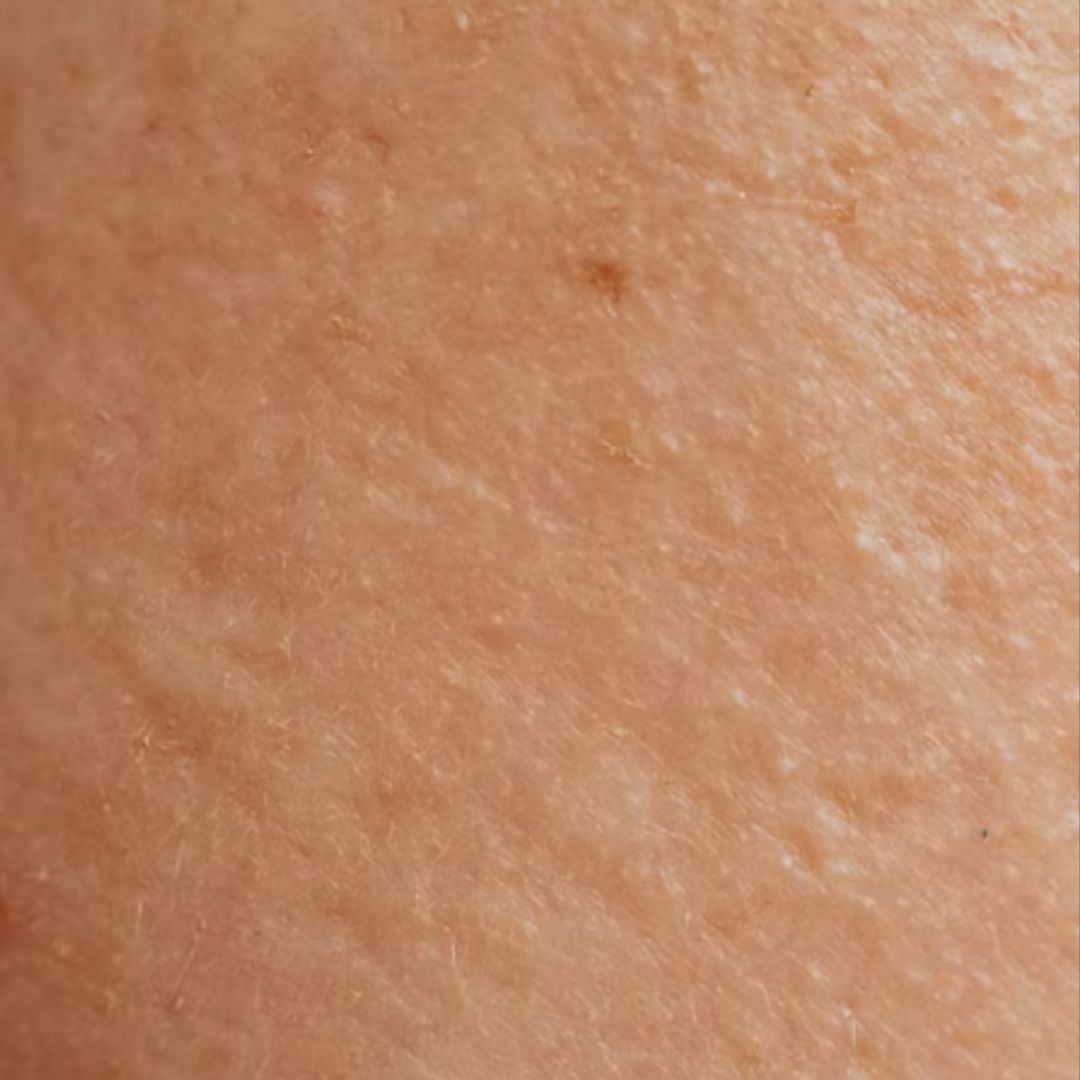 Dull Skin